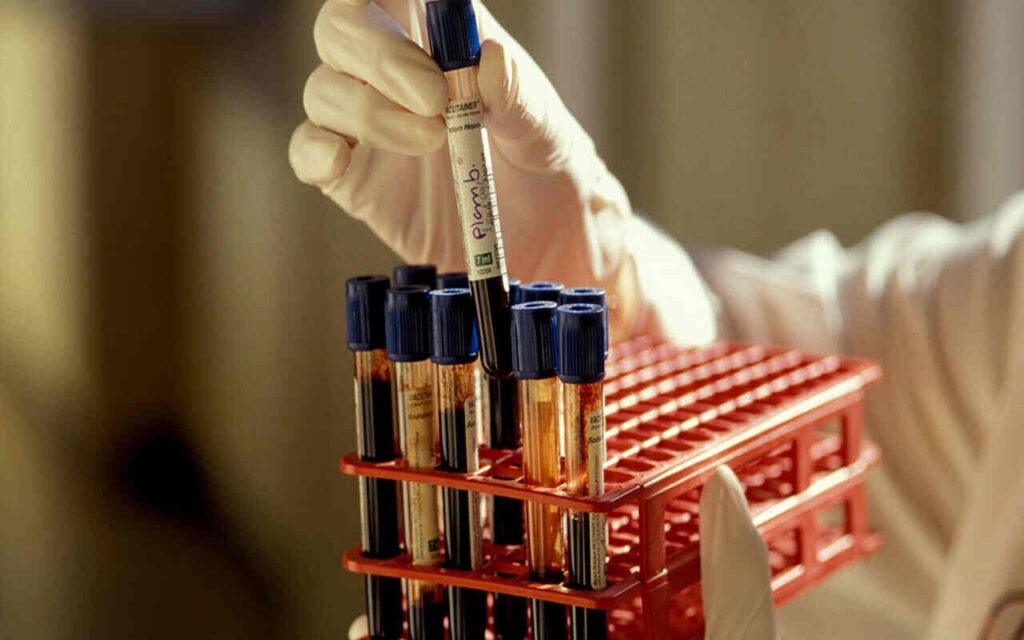 Trigliceridi bassi cosa mangiare: valori, conseguenze, svenimento