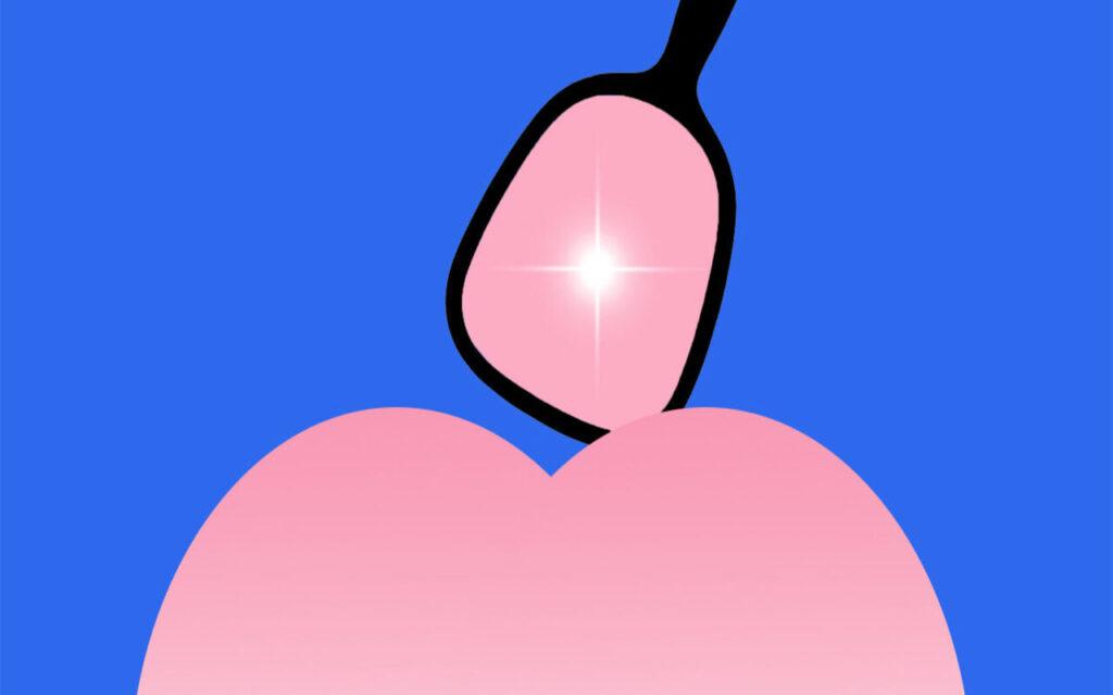 Sbiancamento anale: in cosa consiste, prezzo, opinioni