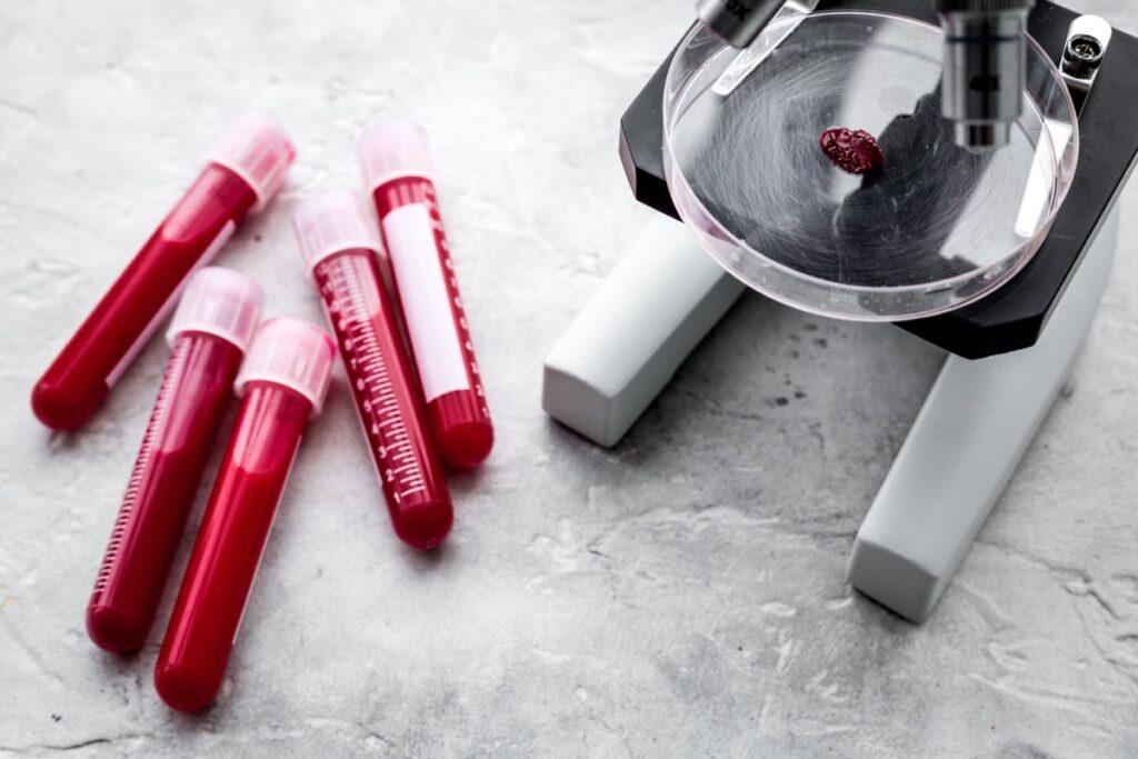 piastrine alte cosa vuol dire