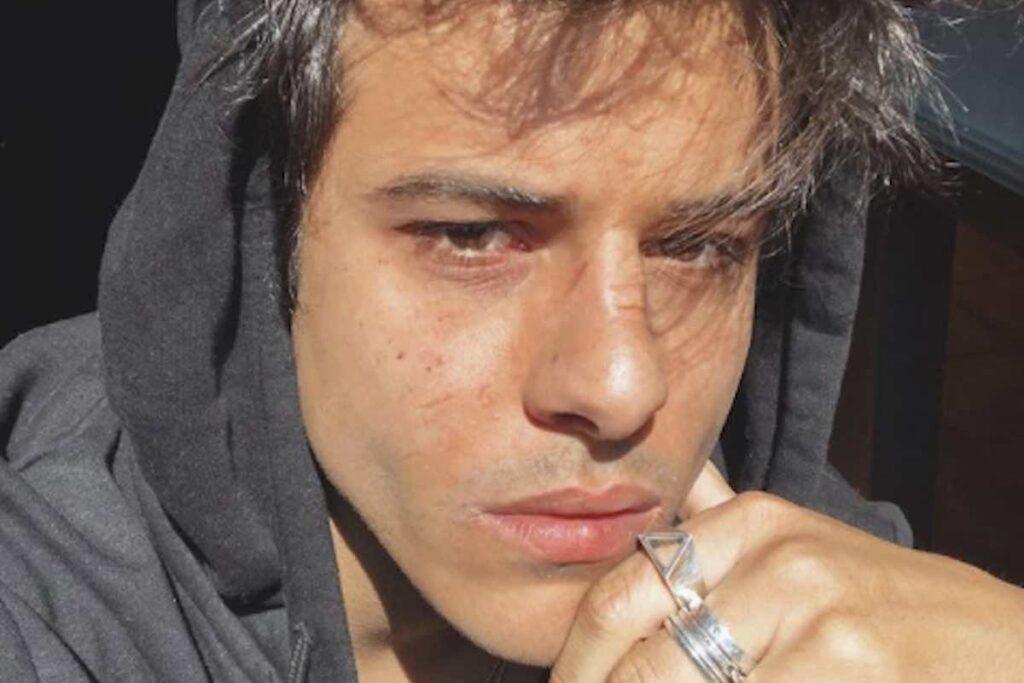 Chi è Michele Merlo: X Factor, Amici, canzoni, vita privata. Com'è morto