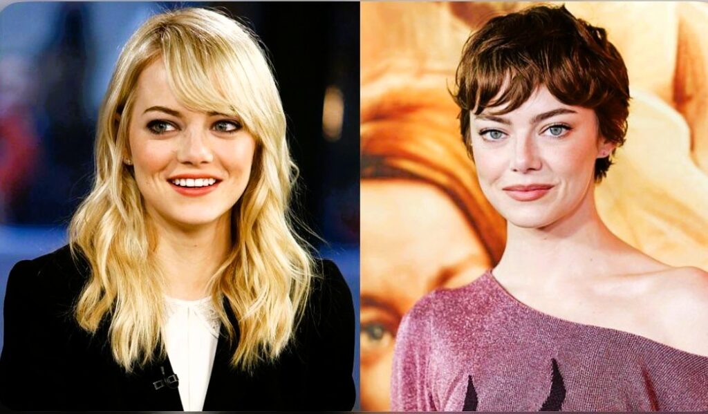 Emma Stone prima e dopo: merito della chirurgia? Cos'è la blefaroplastica