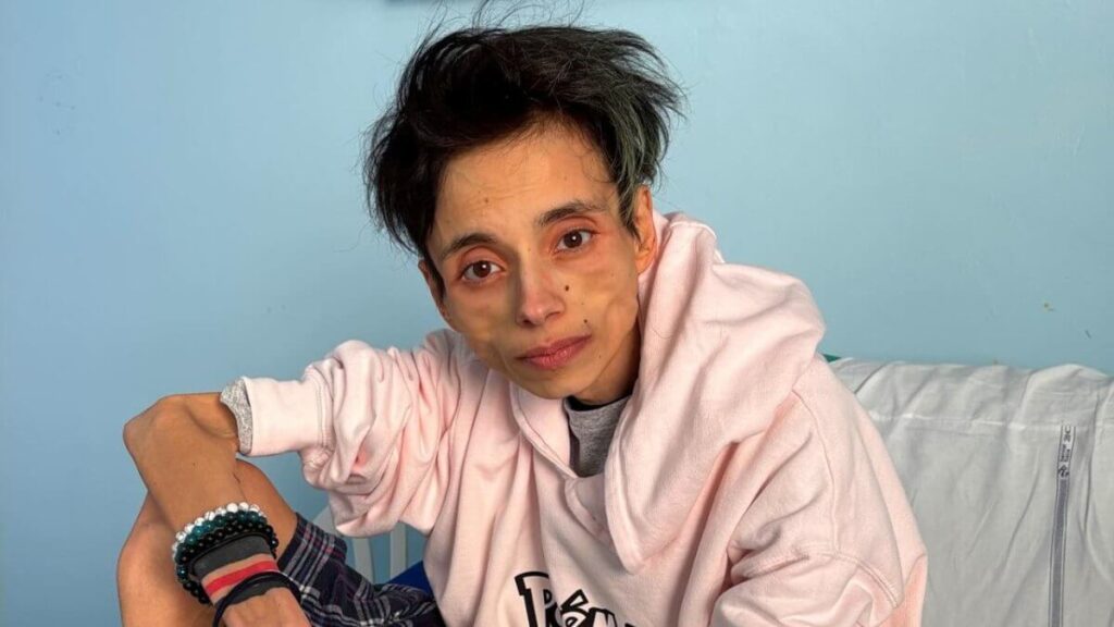 Chi era Thiago Elar, il tiktoker morto a 27 anni dopo mesi in psichiatria: storia, dolore e accuse
