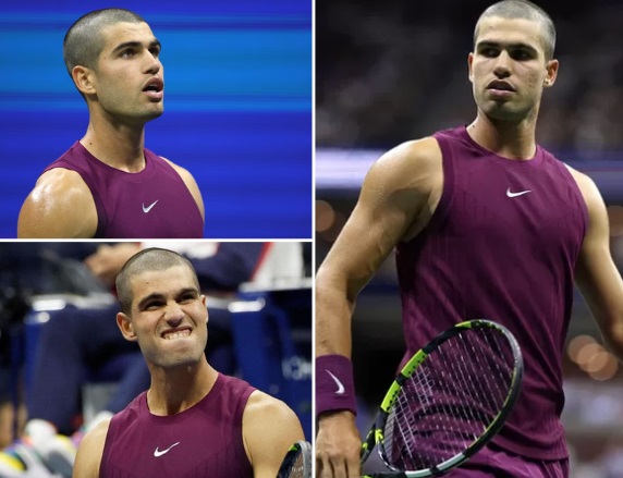 alcaraz rasato a zero