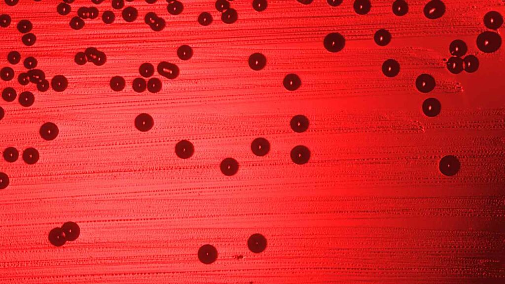 Meningite fulminante taranto